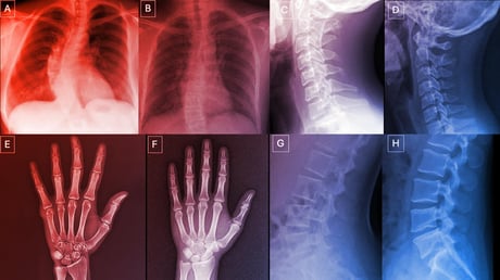 A deepfake röntgenek még az orvosokat is megtévesztik