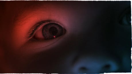 A sertések ihlette forradalmi terápia a szemrák ellen