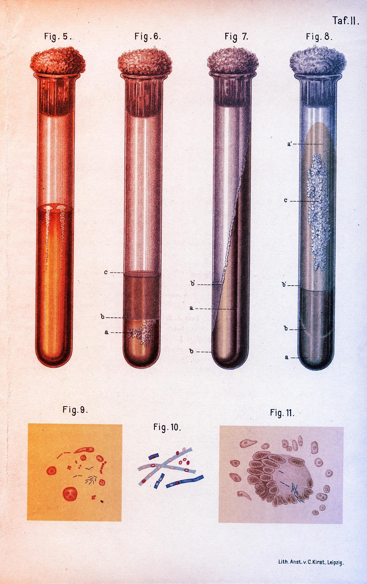 Az elfelejtett gyilkos visszatér: terjed a TBC Amerikában