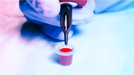 Az eltűnt tetoválás: a nyakára tetovált kereszt végzetes nyomot hagyott