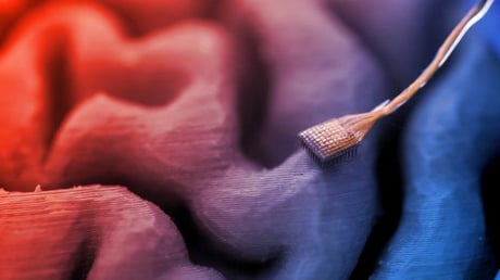 Az MI olvas a fejünkben: félelmetes vagy korszakalkotó?