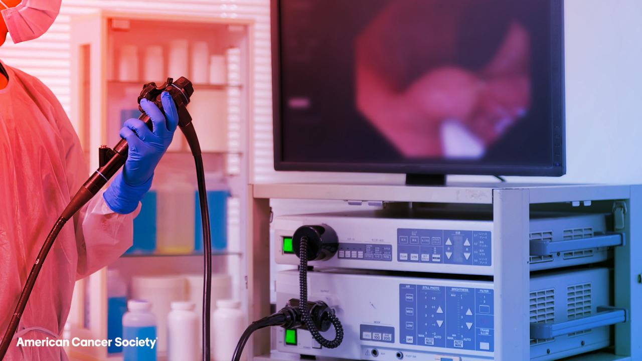 Az USA-ban berobban a vastagbélrák az 50 év alattiaknál