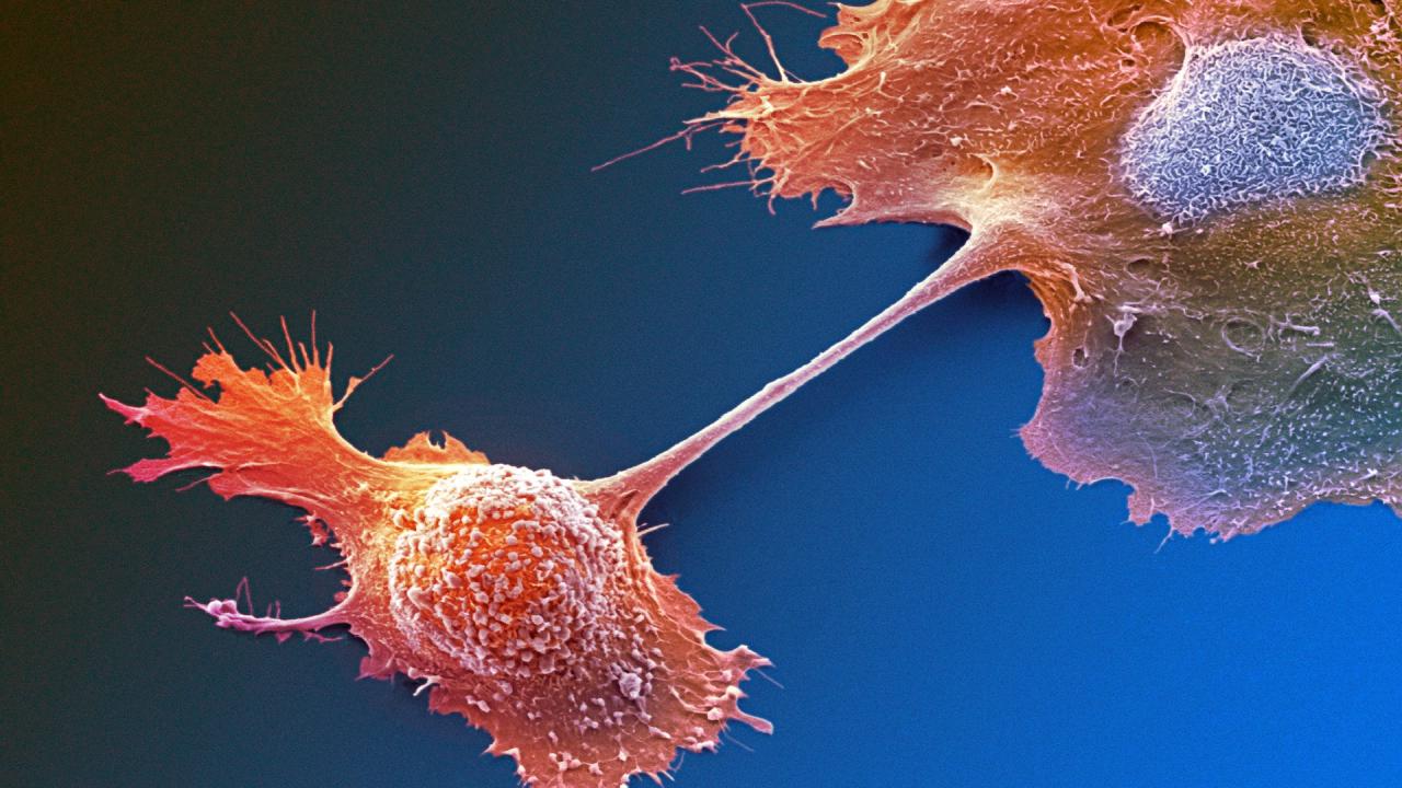 A hasnyálmirigyrák új reménye: az elraglusib áttörést hozhat