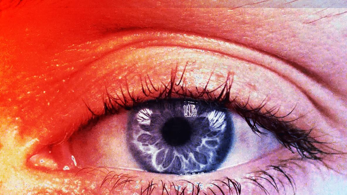 A legújabb őrület: veszélyes szemszínműtétekért rajonganak a fiatalok