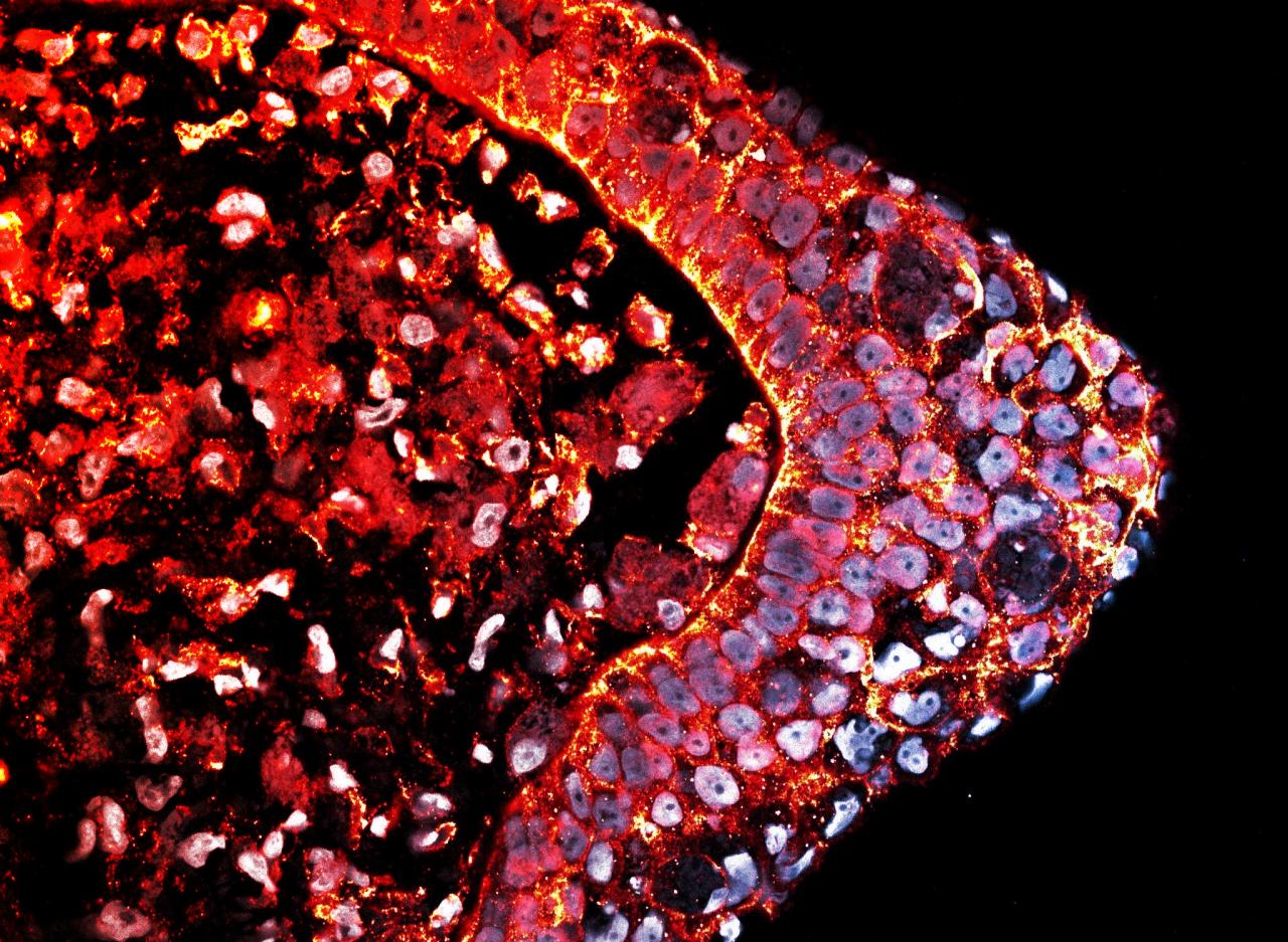 A nagy rejtély: miért nem nőnek vissza a végtagjaink?