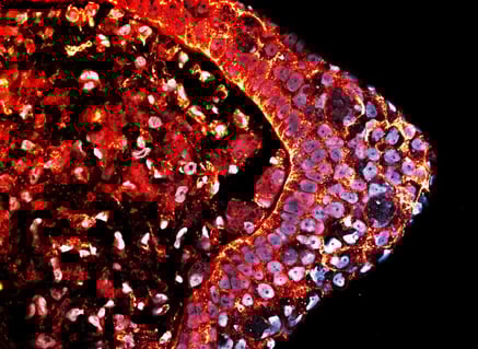 A nagy rejtély: miért nem nőnek vissza a végtagjaink?