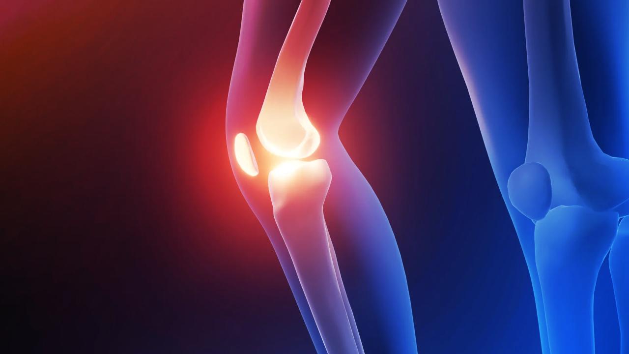 A térdfájdalom ellenszere: egy speciális cipő és bicikli?