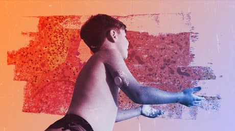 Az 1-es típusú cukorbetegség legyőzése már a küszöbön?