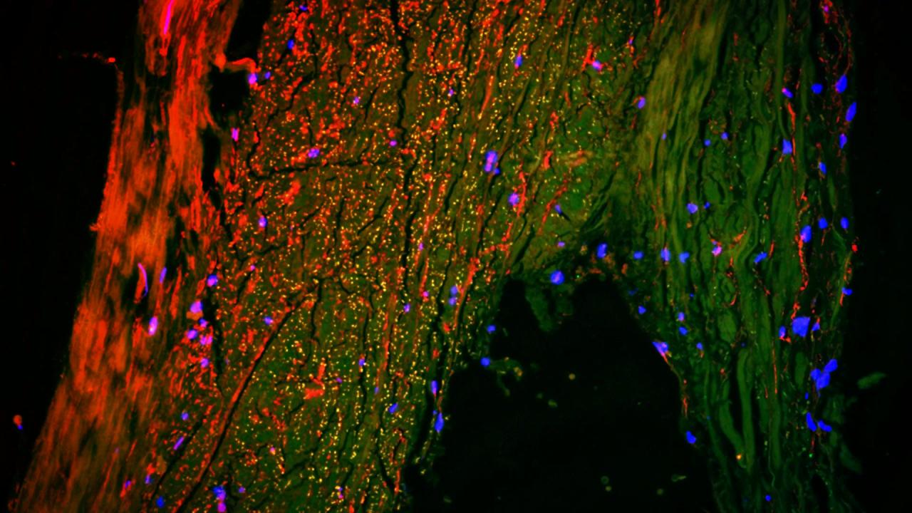 Az agy rejtett csatornája: áttörés jöhet az Alzheimer ellen?