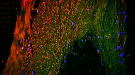 Az agy rejtett csatornája: áttörés jöhet az Alzheimer ellen?