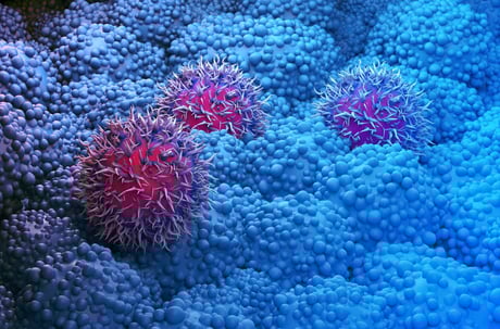 Az áttörés küszöbén: új gyógyszer reményt hoz a hasnyálmirigyrákban