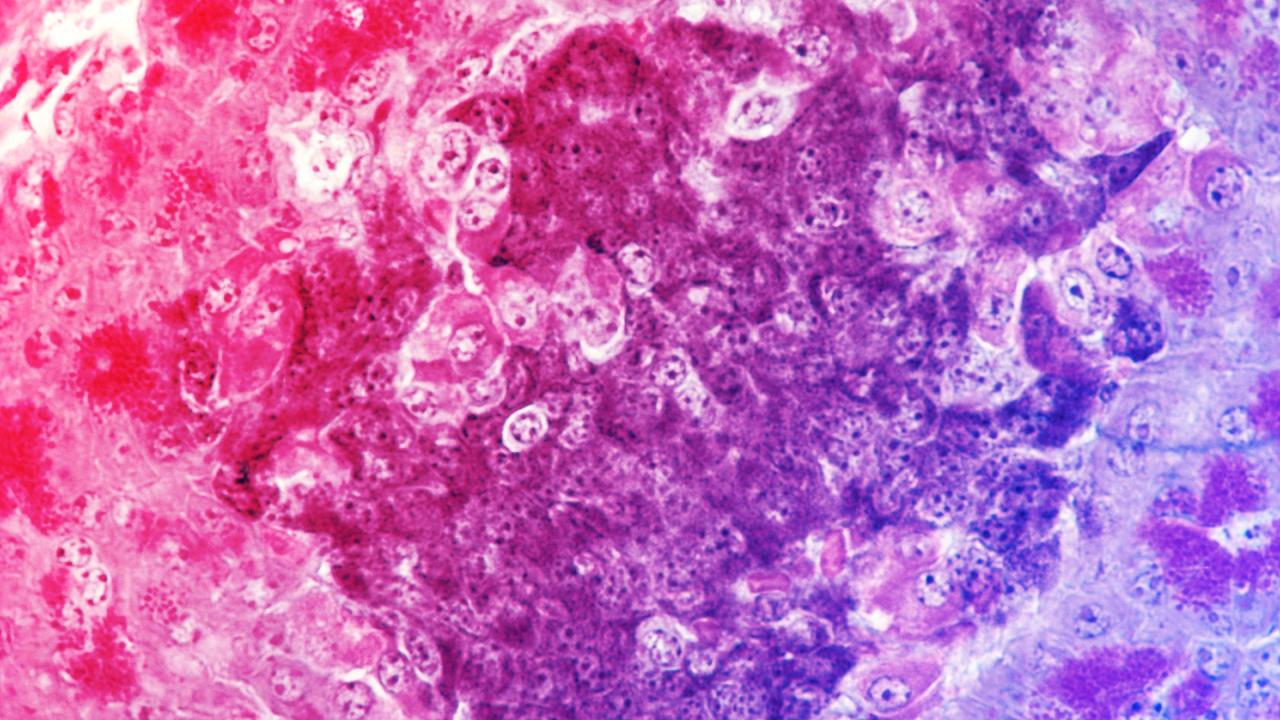 Az egérkísérlet, amely forradalmasíthatja a cukorbetegség kezelését