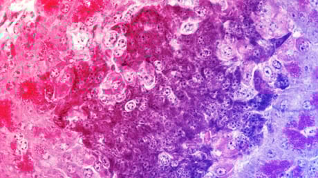 Az egérkísérlet, amely forradalmasíthatja a cukorbetegség kezelését