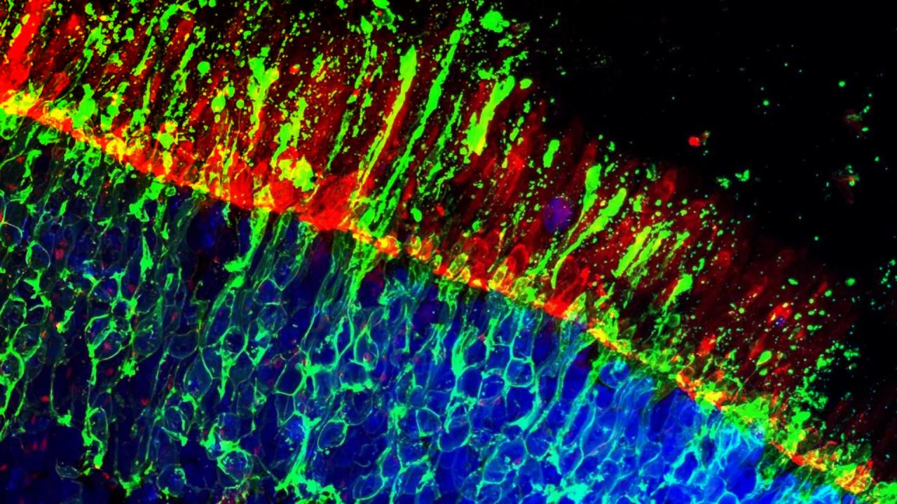 Az éleslátás jövője: forradalmi módszer óvhatja a szemed