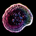 Az első 3D-s felvétel, ahogy T-sejtek leszámolnak a rákkal