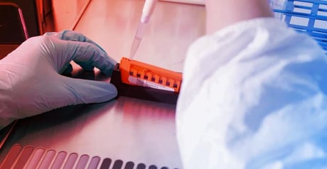 Az első baktériumdob: hallgasd, melyik kórokozó fertőzött meg!