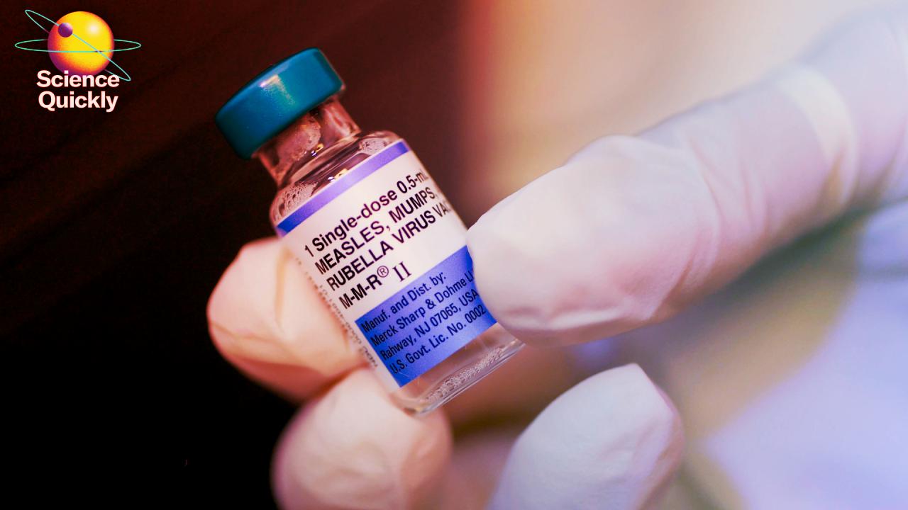 Az oltásellenesség árnyékában kanyarójárvány söpör végig Amerikán