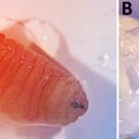 Az orrában fejlődő légylárva – döbbenetes görög eset