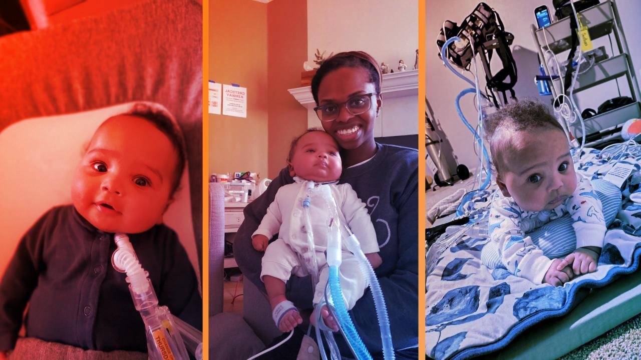 Csodát tettek az anyaméhben: megmentették Cassian életét