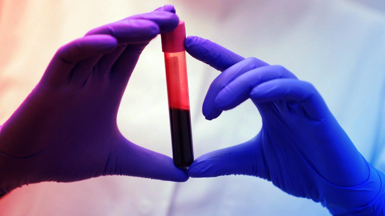 Egy új vérteszt átírhatja a májrák megelőzésének szabályait