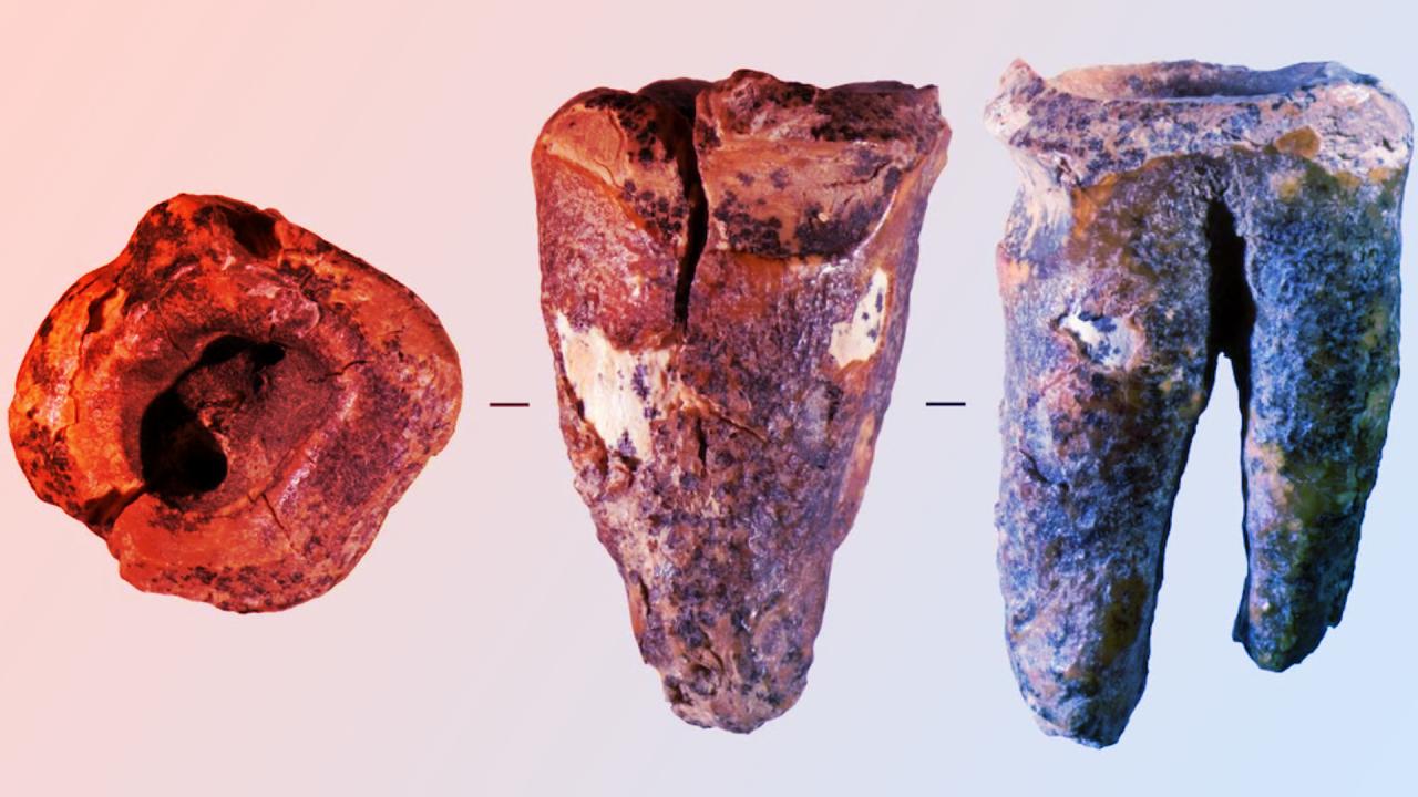A neandervölgyiek már fogorvoskodtak: 60 ezer éves, fúrt fog Szibériából
