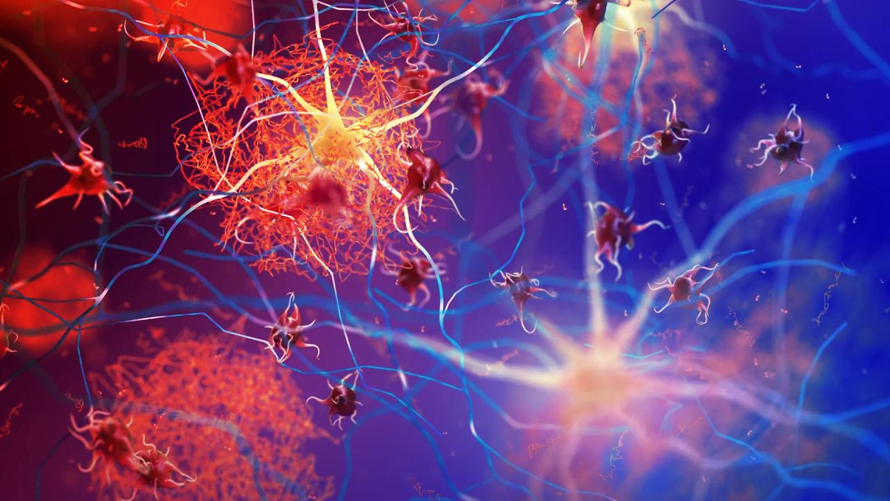 Az agy saját védelme győzheti le az Alzheimer-kórt?