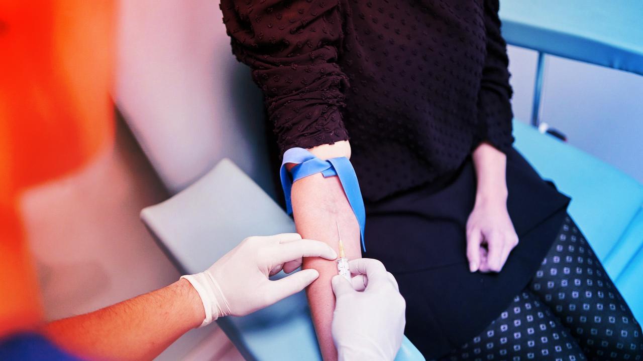 Az áttörést ígérő rák-vérteszt megbukott a nagyszabású vizsgálaton