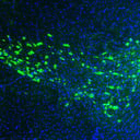 A Yale kutatói megfejthették a Parkinson-kór terjedésének módját