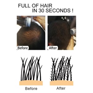 Instant Hair Thickening Fibers for Men and Women product image