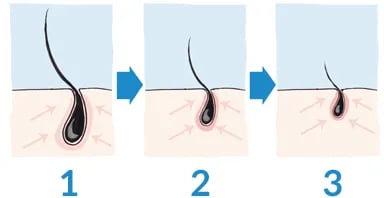 Close-up of damaged hair due to nicotine exposure