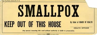 Smallpox