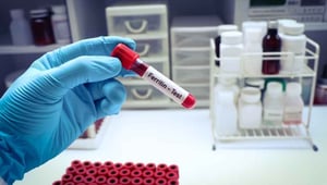 Ferritin Neden Düşük Çıkar? Demir Depolarını Azaltan Nedenler 
