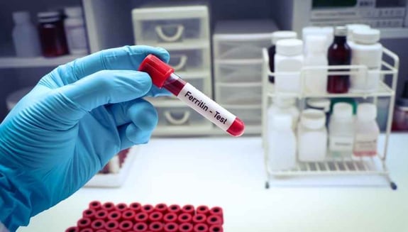 ferritin neden düşer, ferritin düşüklüğü, düşük ferritin belirtileri, demir deposu, demir eksikliği, ferritin nasıl yükselir, demir deposu nasıl yükselir, ferritini düşüren hastalıklar, çölyak ve ferritin, Crohn ve demir eksikliği, yoğun adet kanaması, demir emilim bozukluğu, demir eksikliği anemisi, online dahiliye, online doktor, happ health