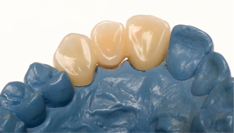 diş protez uygulamaları, protez diş, sabit protez, hareketli protez, tam protez, parsiyel protez, zirkonyum diş, köprü diş, dişsiz ağız, diş protezi bakımı, diş hekimi, protez temizliği, protez ömrü, protez alışma süreci, sabit mi hareketli mi, protez fiyatları, protez kontrolü, diş kaybı tedavisi, protez nedir