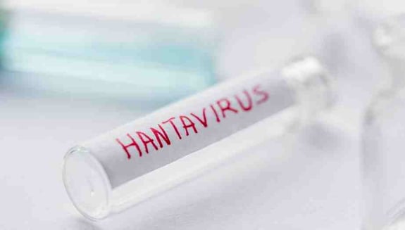 hantavirüs, hantavirüs nedir, hantavirüs belirtileri, hantavirüs nasıl bulaşır, hantavirüs tedavisi, hantavirüs enfeksiyonu, viral enfeksiyonlar, kemirgen kaynaklı hastalıklar