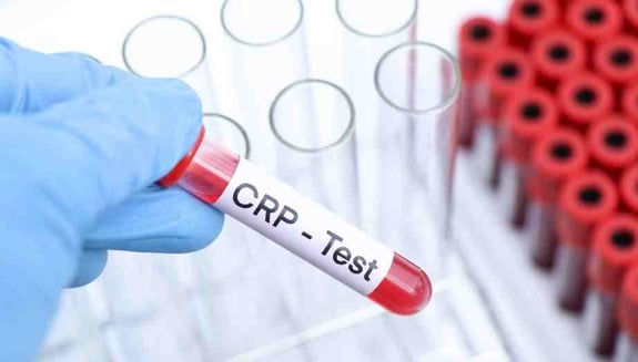 inflamasyon, iltihap belirtileri, check-up, CRP, sedimentasyon, tam kan sayımı, ferritin, otoimmün hastalıklar, kronik inflamasyon, sağlık kontrolü, happ health
