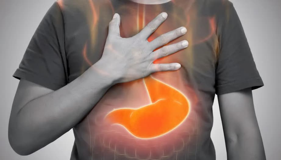 Reflü Hastaları İçin Beslenme Rehberi 