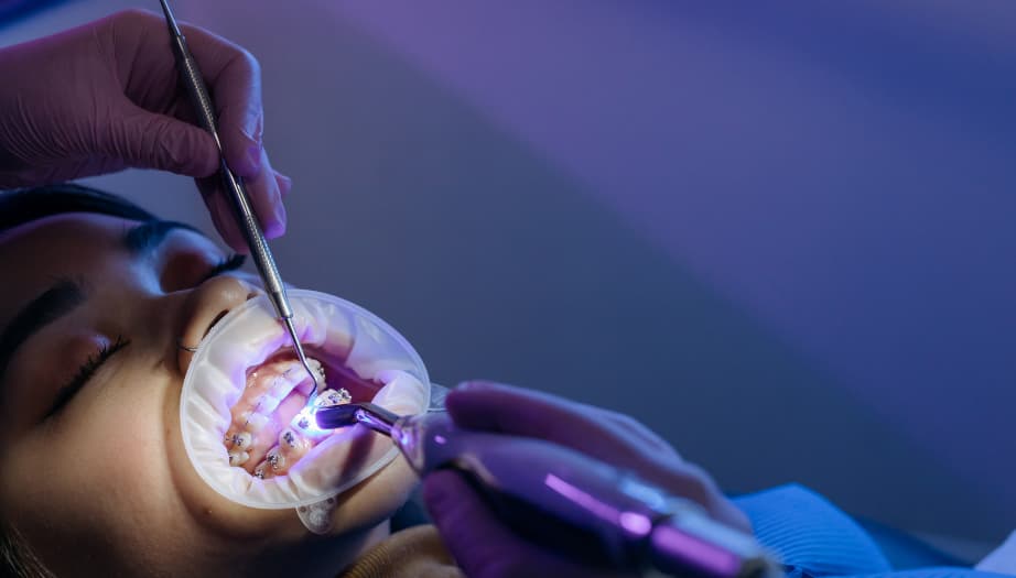 ortodonti tedavisi, diş teli, şeffaf plak, ortodonti yöntemleri, çocuklarda ortodonti, yetişkinlerde diş teli, diş çapraşıklığı, estetik ortodonti, diş hizalama, şeffaf plak tedavisi, ortodonti uzmanı, diş teli süresi, ortodontik problemler, çene yapısı bozukluğu, diş sağlığı, gülüş estetiği, metal diş teli, görünmez plak, diş teli acıtır mı, ortodontik tedavi süreci, ortodonti tedavisi nedir, ortodonti tedavisi fiyatları 2025, ortodonti diş tedavisi nedir, ortodonti tedavisi fiyatları, ortodonti tedavisi nasıl yapılır, ortodonti tedavisi ne kadar sürer, ortodonti çene tedavisi, ortodonti plak tedavisi, ortodonti diş teli tedavisi