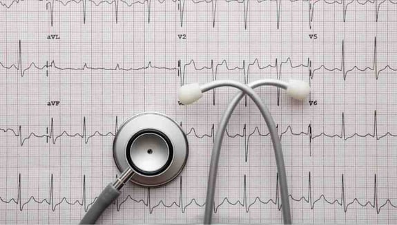 check up ekg sonuçları, ekg nasıl yorumlanır, ekg sonucu ne anlama gelir, ritim bozukluğu ekg, kalp kontrolü check up, elektrokardiyografi yorumu, happ health