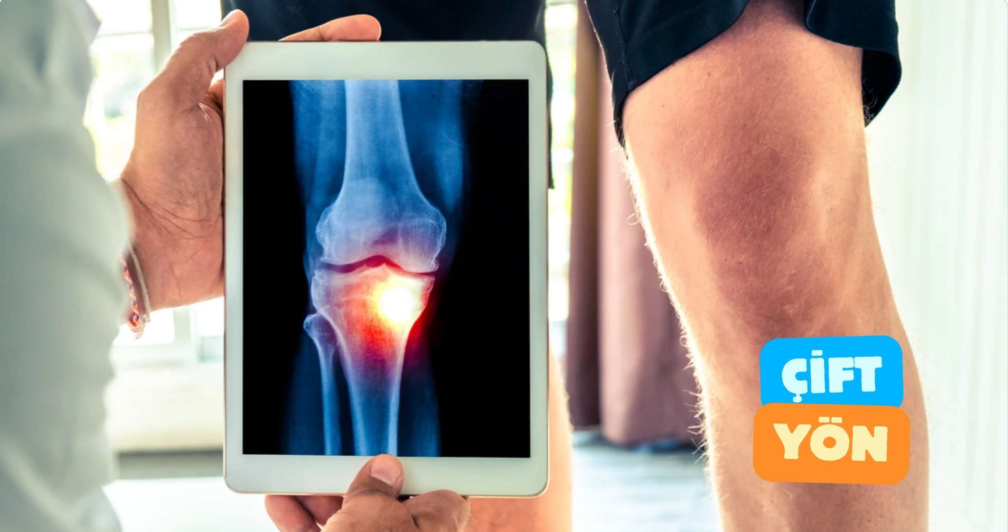 Evde Röntgen Çekimi (Çift Yön)