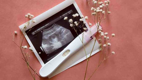 hamilelik öncesi check up, gebelik öncesi testler, anne adayları için check up, prekonsepsiyonel değerlendirme, hamilelik planlama, folik asit, genetik tarama, kadın sağlığı, happ health