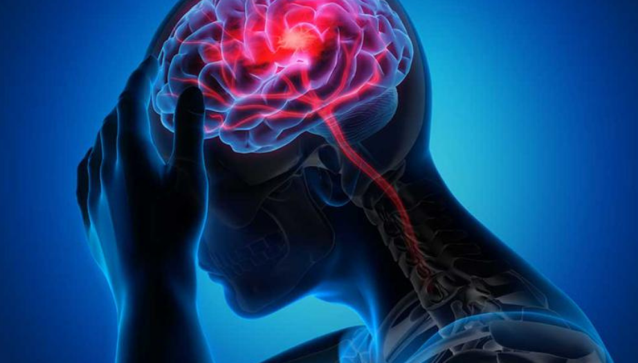 beyin apsesi, beyin apsesi belirtileri, beyin apsesi tedavisi, beyin apsesi nedenleri, beyin apsesi tanısı, beyin apsesi cerrahi müdahale, beyin apsesi ameliyatı, beyin apsesi ölüm riski, beyin apsesi nedir, beyin apsesi nasıl anlaşılır, beyin apsesi çocuklarda, beyin apsesi MR görüntüleri, beyin apsesi hangi doktora gidilir, beyin apsesi komplikasyonları, beyin apsesi iyileşme süreci