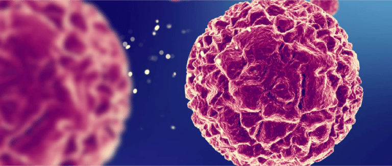 Adenocarcinoma