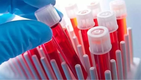 kan iltihabı, sepsis, enfeksiyon, sepsis belirtileri, sepsis tedavisi, kan zehirlenmesi, bağışıklık sistemi, antibiyotik tedavisi, kan enfeksiyonu, sağlık