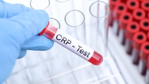 CRP Nedir? CRP Yüksekliği Ne Anlama Gelir?