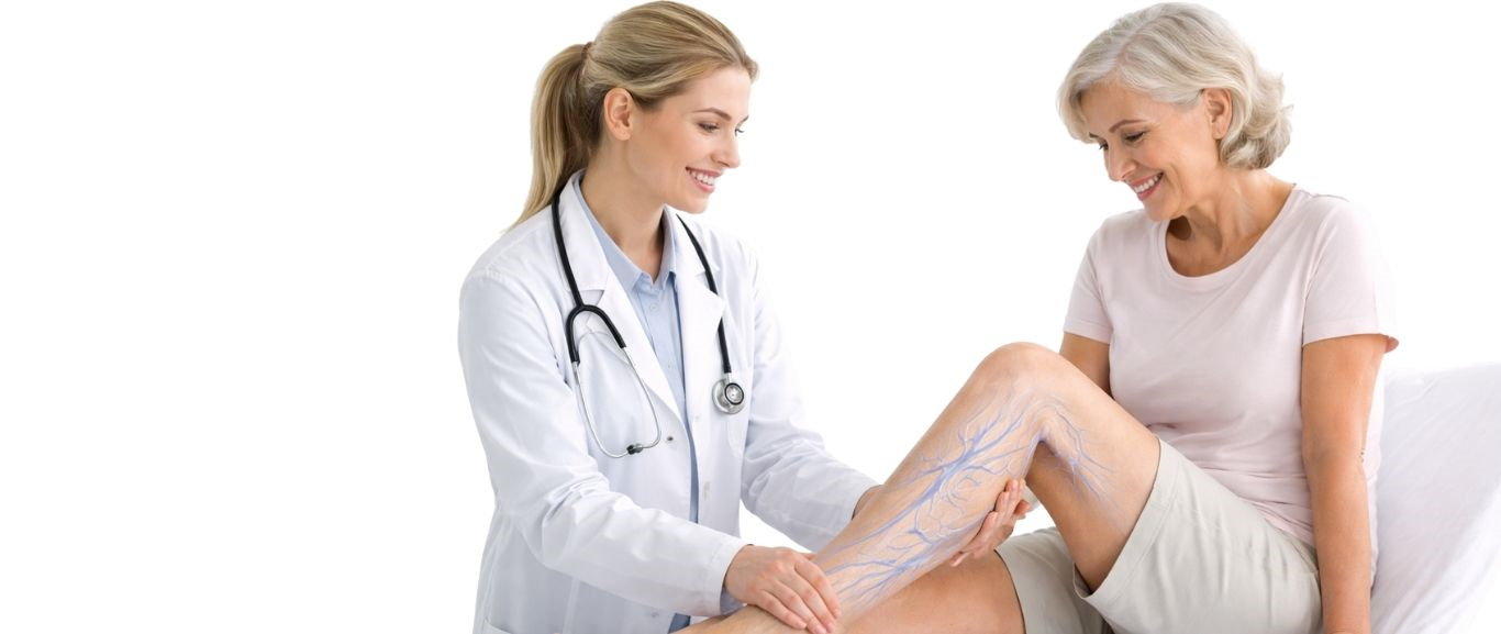 Vascular Health Veins