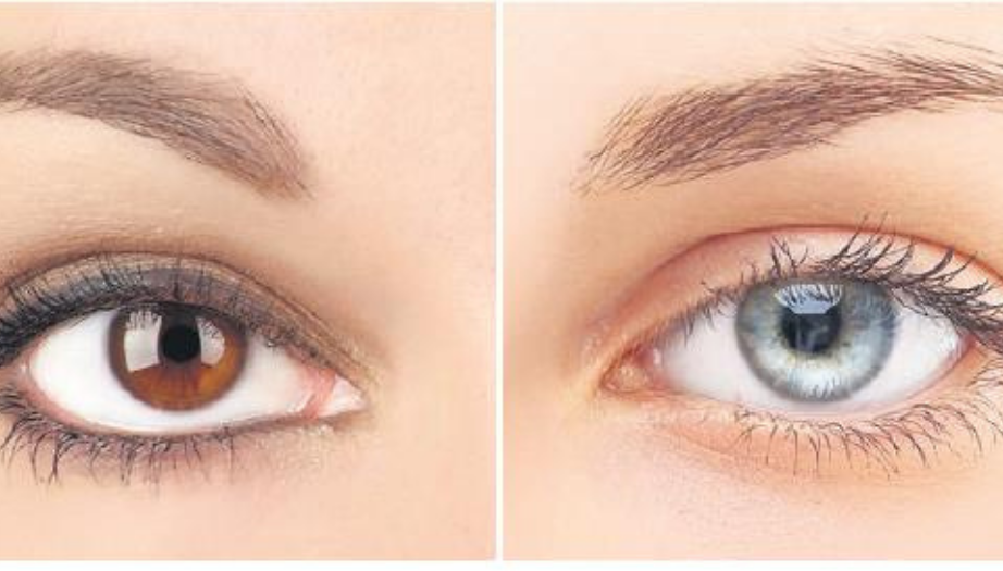 göz rengi değiştirme, lazerle göz rengi açma, iris implantasyonu, göz sağlığı, estetik ameliyat, göz rengi değişikliği, renkli kontakt lens, göz ameliyatı riskleri, göz sağlığına zarar, estetik göz ameliyatı