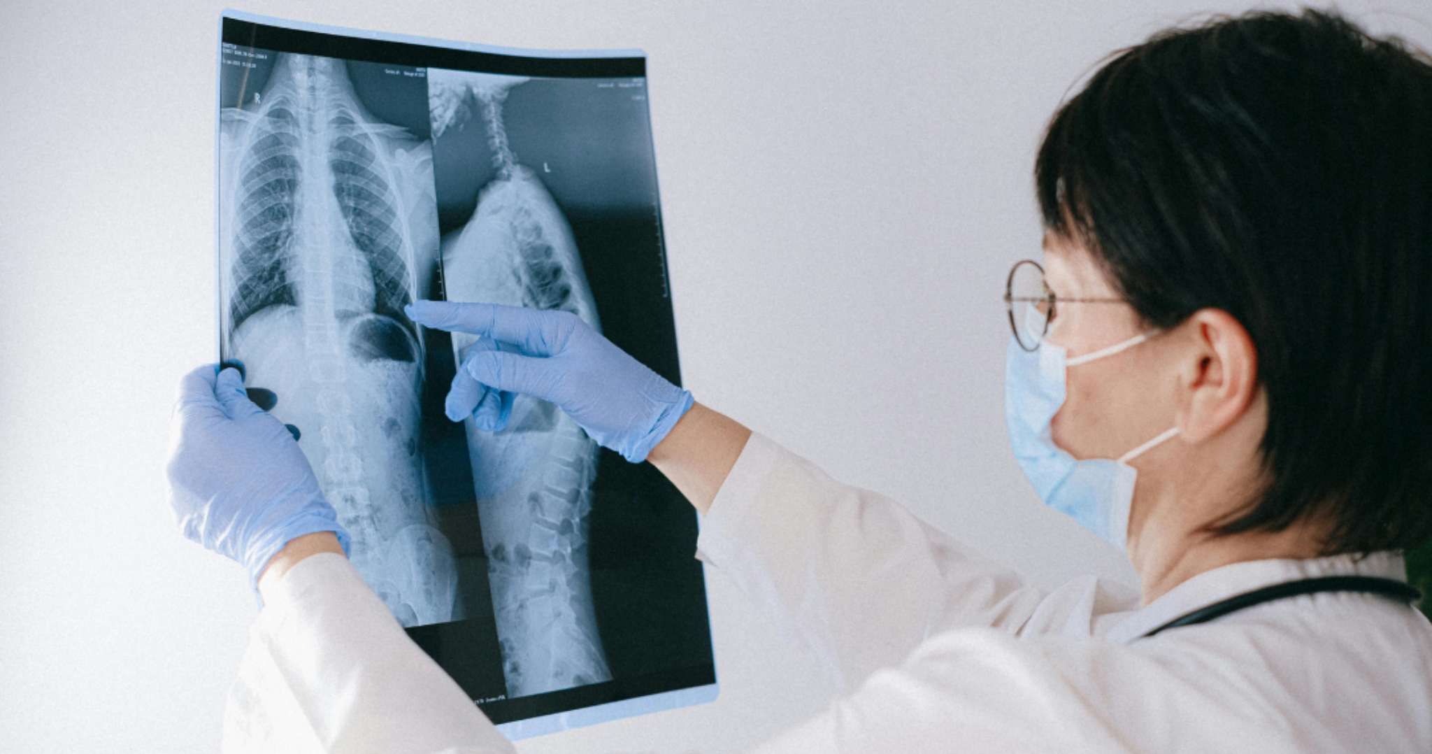 X-Ray (Two-View) Service at Home