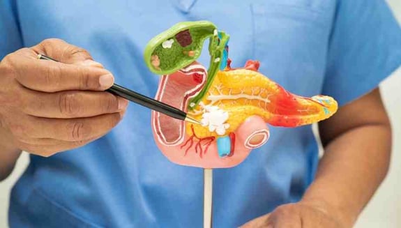 safra kesesi taşı, safra kesesi taşı belirtileri, safra taşı nedir, safra taşı neden olur, safra kesesi çamuru, safra taşı teşhisi, safra taşı ağrısı,happ health