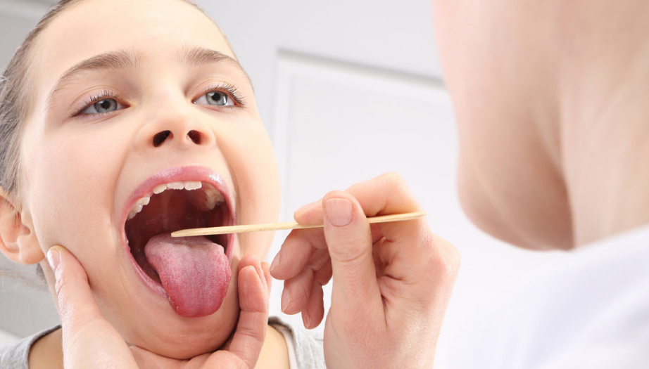 küçük dil iltihabı, uvulit nedir, boğaz şişmesi, küçük dil şişmesi, uvulit tedavisi, boğaz ağrısı, yutkunma zorluğu, enfeksiyon belirtileri